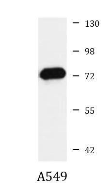 Anti-MMP25