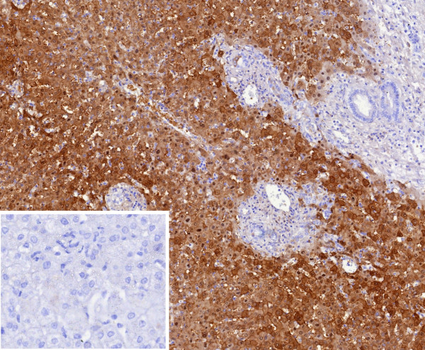 Anti-Arginase 1 (Hepatocellular Carcinoma Marker), clone ARG1/9447