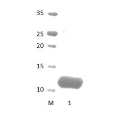 FRMPD2_2 PDZ Domain