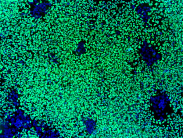 Human Induced Pluripotent Stem Cell-derived Neural Crest Cells