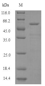 Histidine--tRNA ligase, cytoplasmic (HARS1),partial, human, recombinant