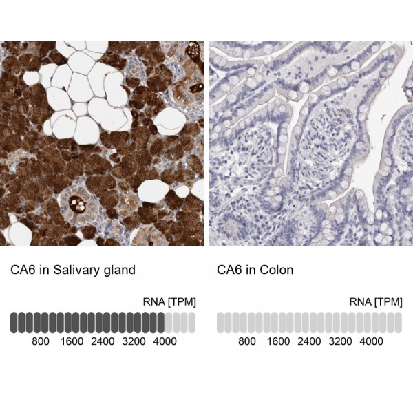 Anti-CA6