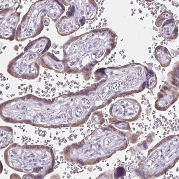 Anti-CDH19