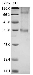 Probable G-protein coupled receptor 146 (GPR146), human, recombinant
