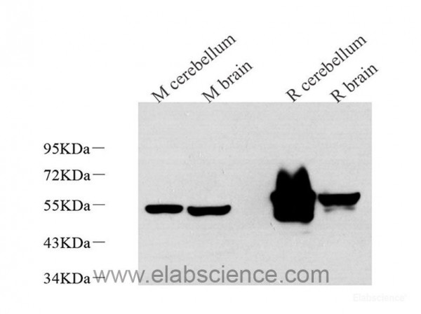 Anti-GFAP, clone 2B12F1