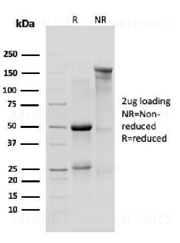 Anti-IL-10R1, Mouse (Interleukin-10 Receptor 1) (CD210) Monoclonal Antibody (Clone: 1B1.3a)