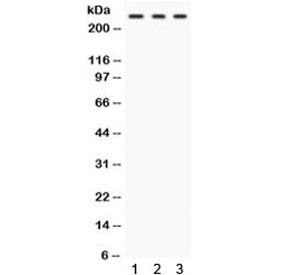 Anti-FASN / Fatty acid synthase