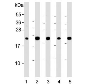 Anti-GPX1 / Glutathione Peroxidase 1