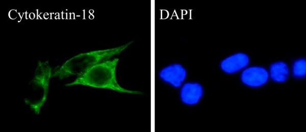 Anti-Cytokeratin 18, clone SQab1882