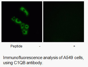 Anti-C1QB