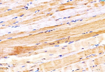 Anti-MYH6 / Myosin 6