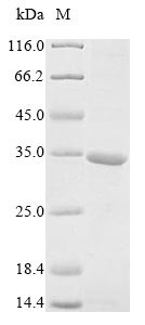 AT-rich interactive domain-containing protein 1A (ARID1A), partial, human, recombinant