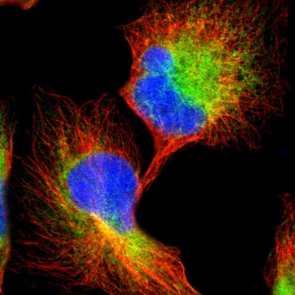 Anti-CLCC1