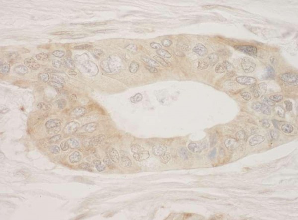 Anti-RSK2 (IHC)