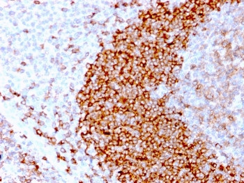 Anti-CD79b, clone IGB/3170R