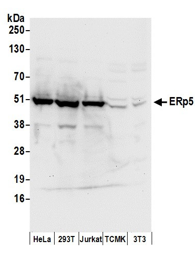 Anti-ERp5