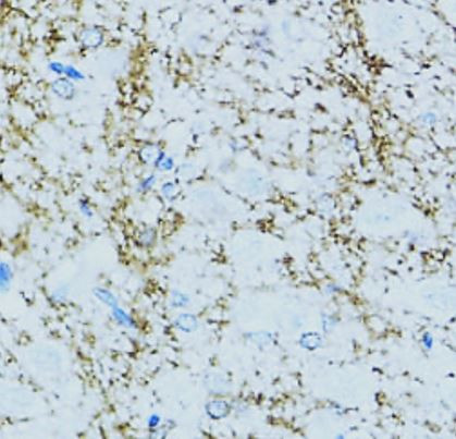 Anti-CNPase