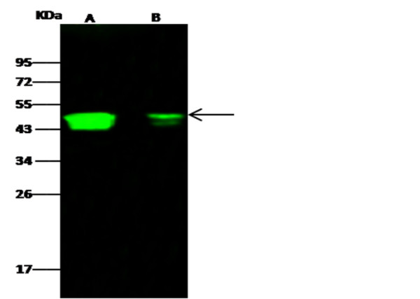Anti-CCR1/CD191 Monoclonal Recombinant Antibody