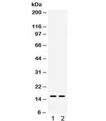 Anti-TTR / Transthyretin / Prealbumin