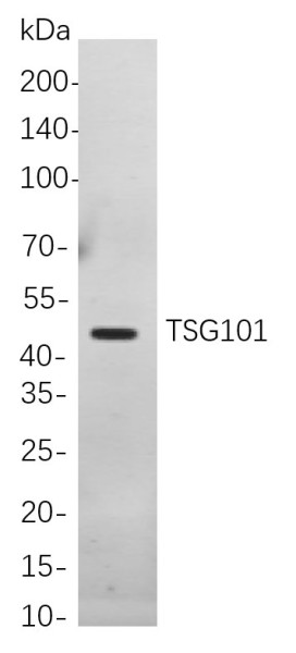 Anti-Recombinant TSG101, clone 5A4
