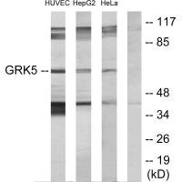 Anti-GRK5