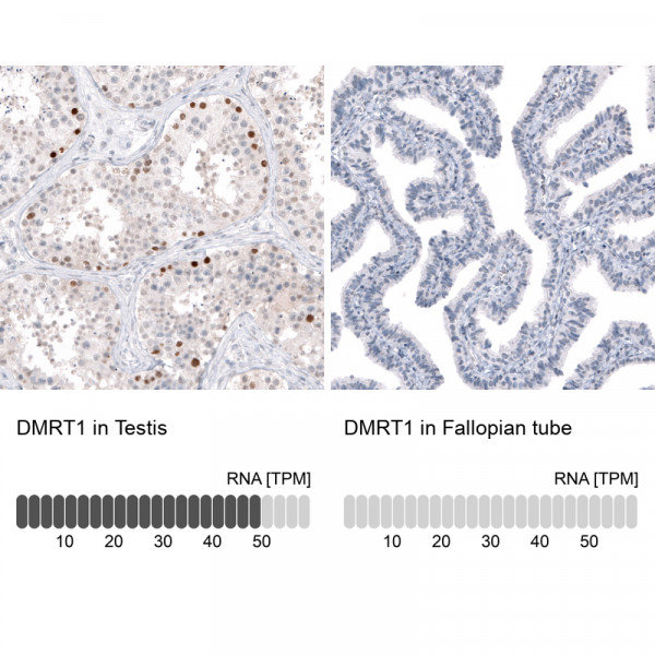 Anti-DMRT1