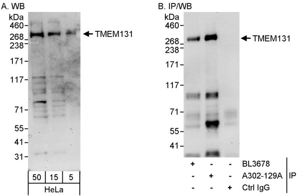 Anti-TMEM131