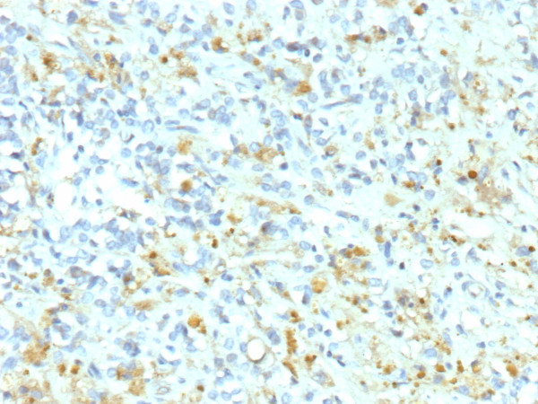 Anti-ALK (Anaplastic Lymphoma Kinase) / CD246, recombinant antibody, clone ALK1/9660R