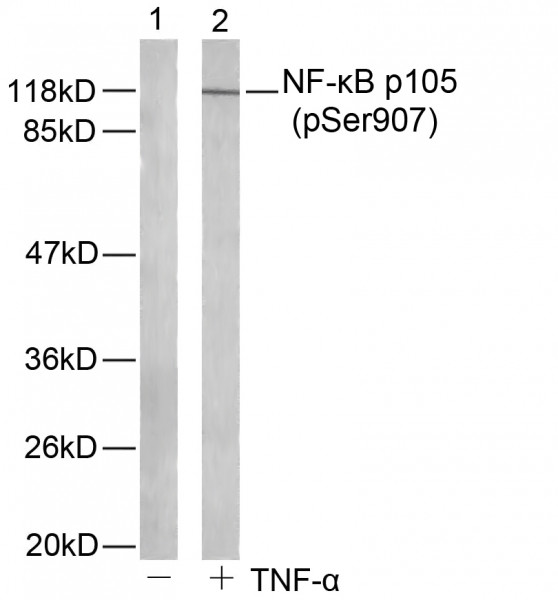 Anti-phospho-NFkB p105/p50 (Ser907)