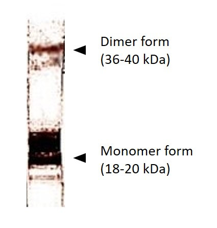 Anti-HPV16 E7, clone 716-D1