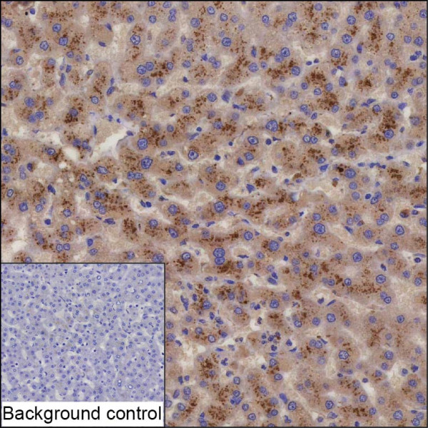 Anti-ACSL3
