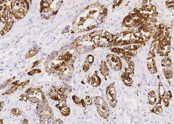 Anti-TSPAN1 Monoclonal Recombinant Antibody