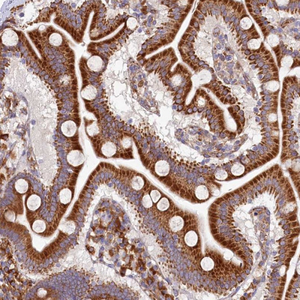Anti-CHID1