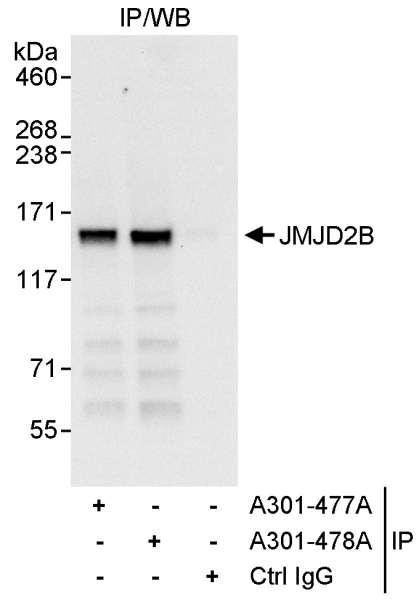 Anti-JMJD2B