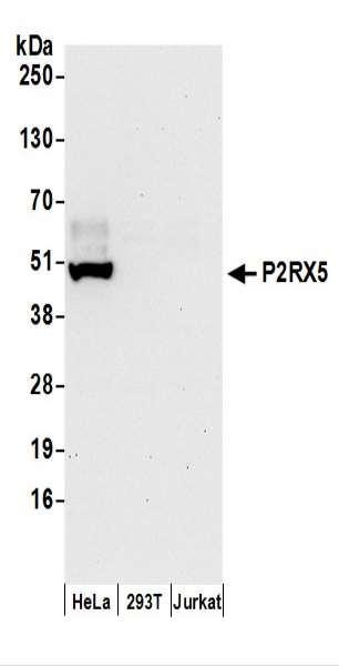 Anti-P2RX5