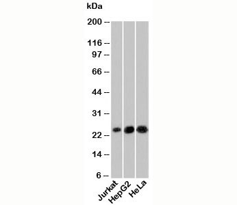 Anti-NKIRAS1, clone NRAS285