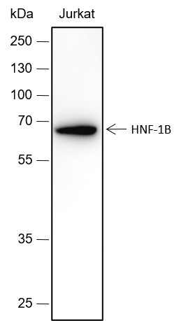 Anti-Recombinant HNF-1B, clone A434