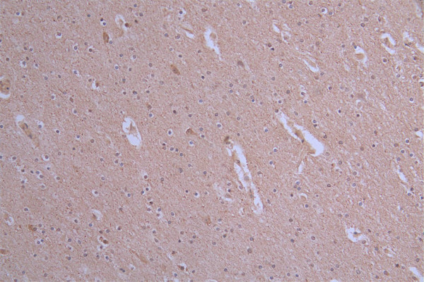 Anti-ATP7B Recombinant Monoclonal, clone 36D12