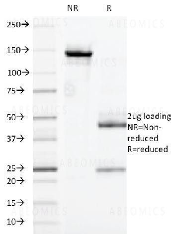 Anti-CD32 (Fc Gamma RIIa) Monoclonal Antibody (Clone: 7.3)