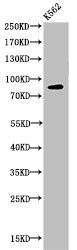 Anti-Acetyl-HSP90AA1 (K292/284)
