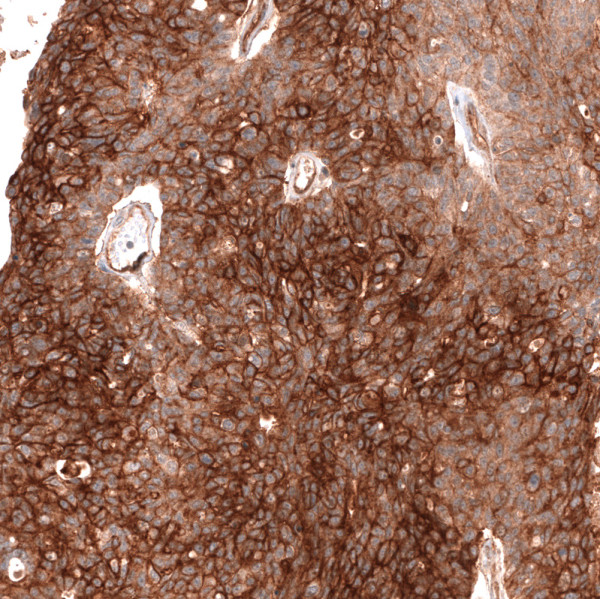 Anti-ABCB5, clone CL14039