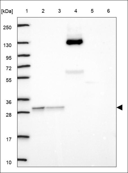 Anti-OVCA2