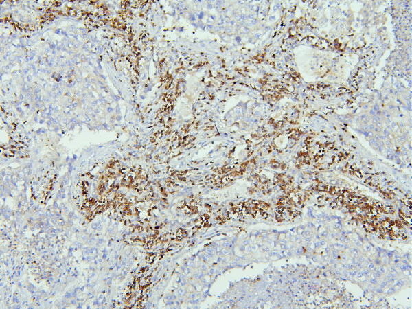 Anti-NHERF1 / EBP50