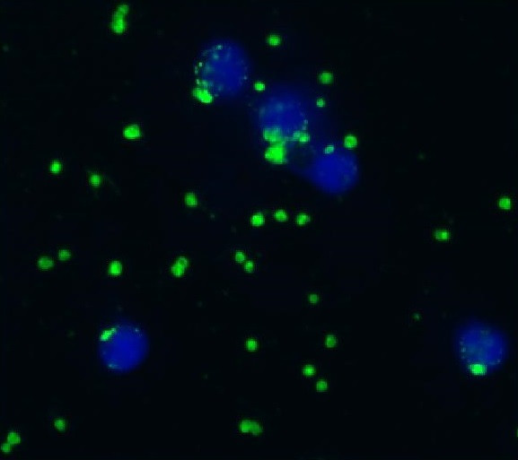 Anti-Integrin alpha 2b + beta 3, clone IVA30