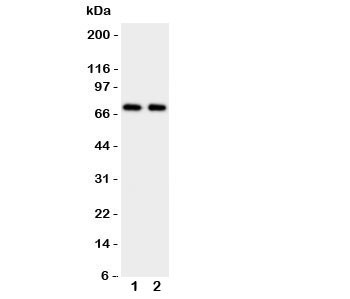 Anti-Prolactin Receptor
