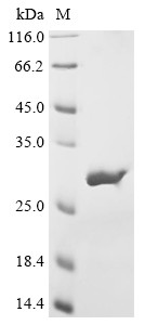 Heat shock protein 90 (hsp90), partial, Aspergillus fumigatus, recombinant