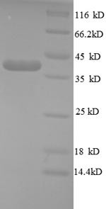 Teratocarcinoma-derived growth factor 1 (TDGF1), partial, human, recombinant