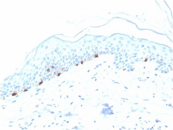 Anti-TRP1 / Tyrosinase-Related Protein-1, clone TYRP1/3280