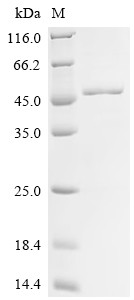 Poly [ADP-ribose] polymerase 1 (PARP11), partial, human, recombinant