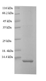Myelin proteolipid protein (plp), partial, Oncorhynchus mykiss, recombinant